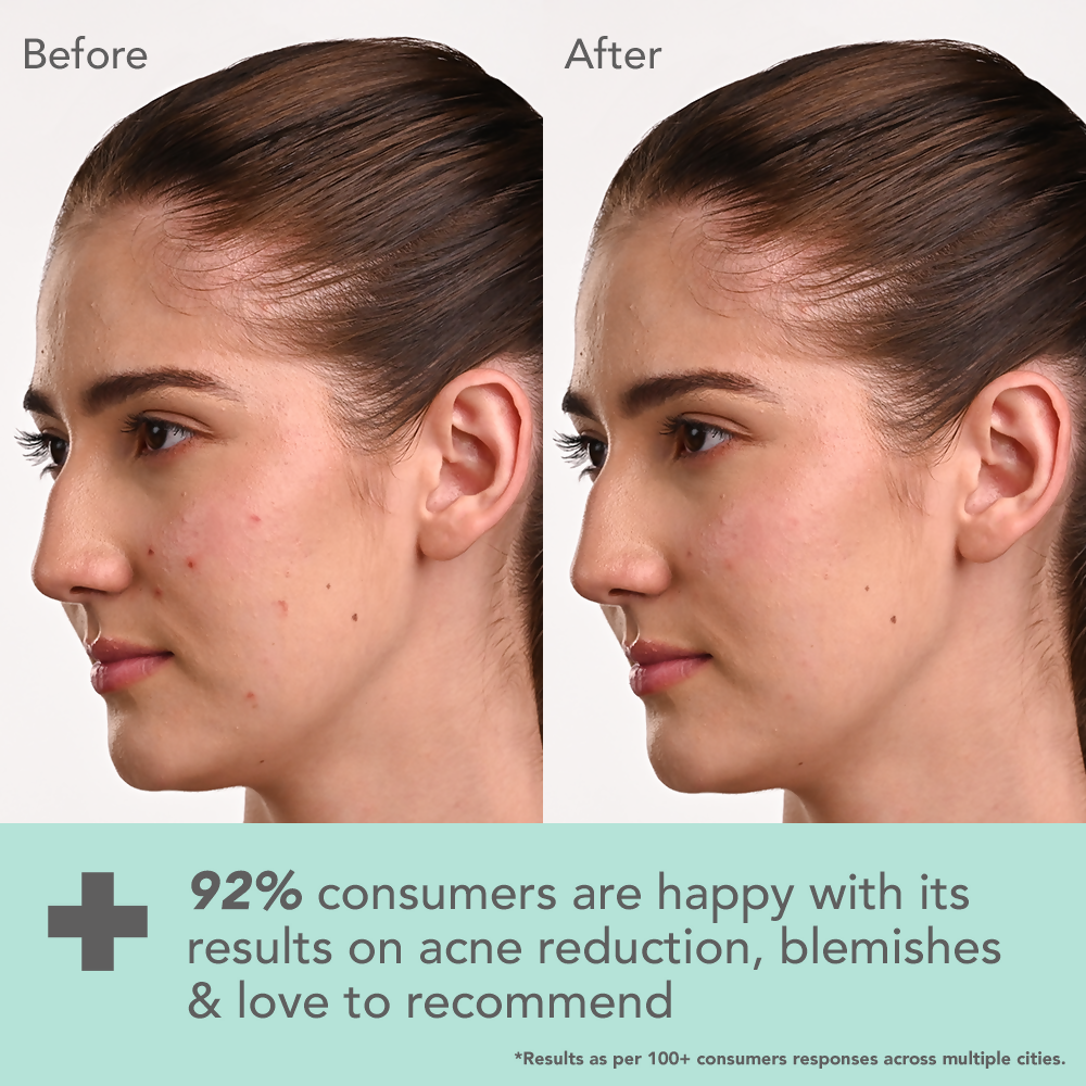 Lotus DermaBotanics Kojic acid + Multi berry Blemish - Free Facewash | Grocsy