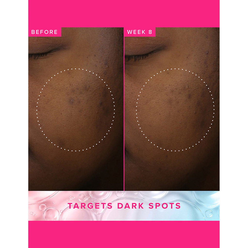 Farmacy Beauty Brighten Up 3% TXA Dark Spot Toner | Grocsy