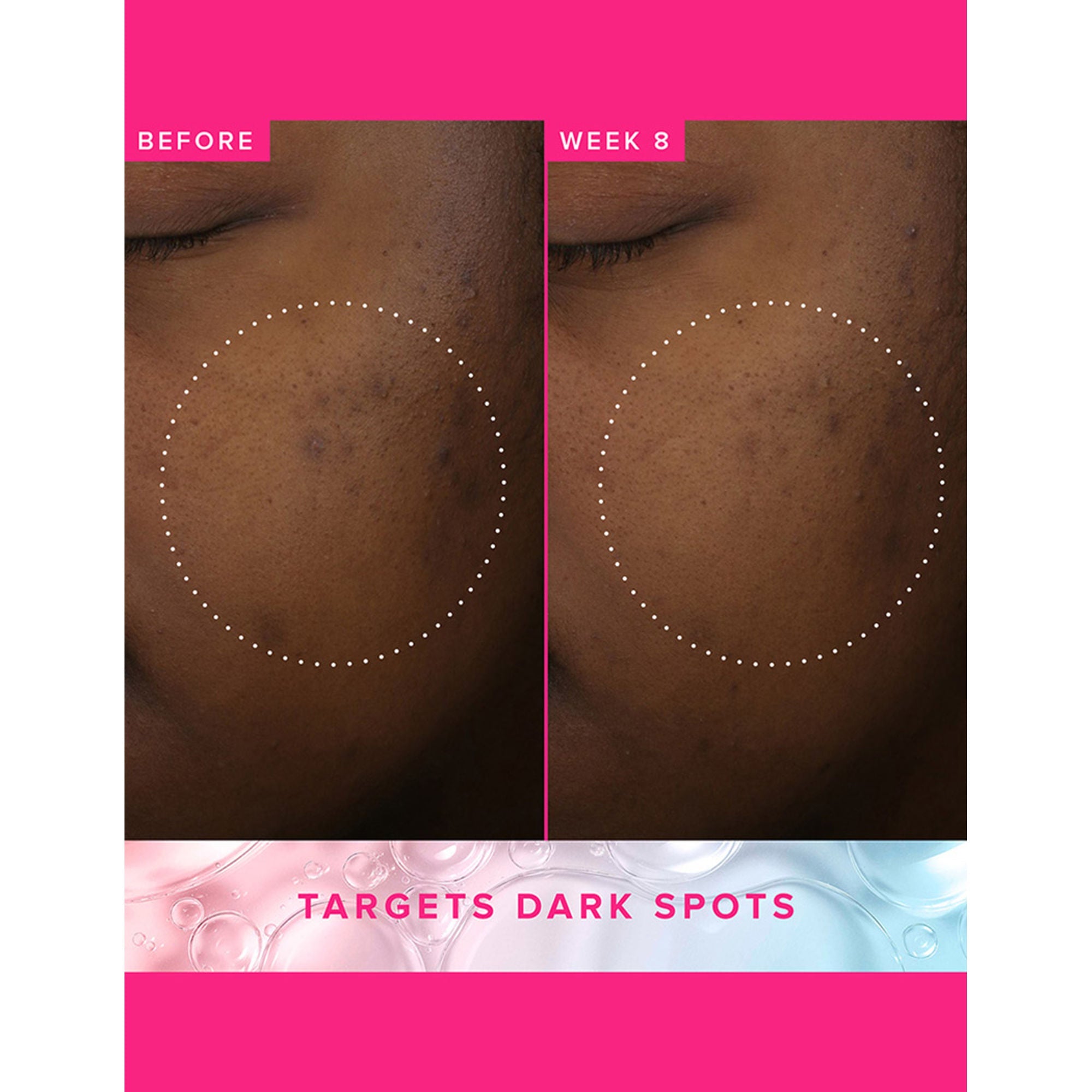 Farmacy Beauty Brighten Up 3% TXA Dark Spot Toner | Grocsy