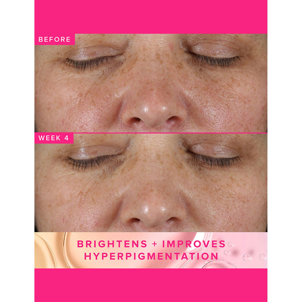 Farmacy Beauty Brighten Up 3% TXA Dark Spot Toner | Grocsy