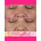 Farmacy Beauty Brighten Up 3% TXA Dark Spot Toner | Grocsy