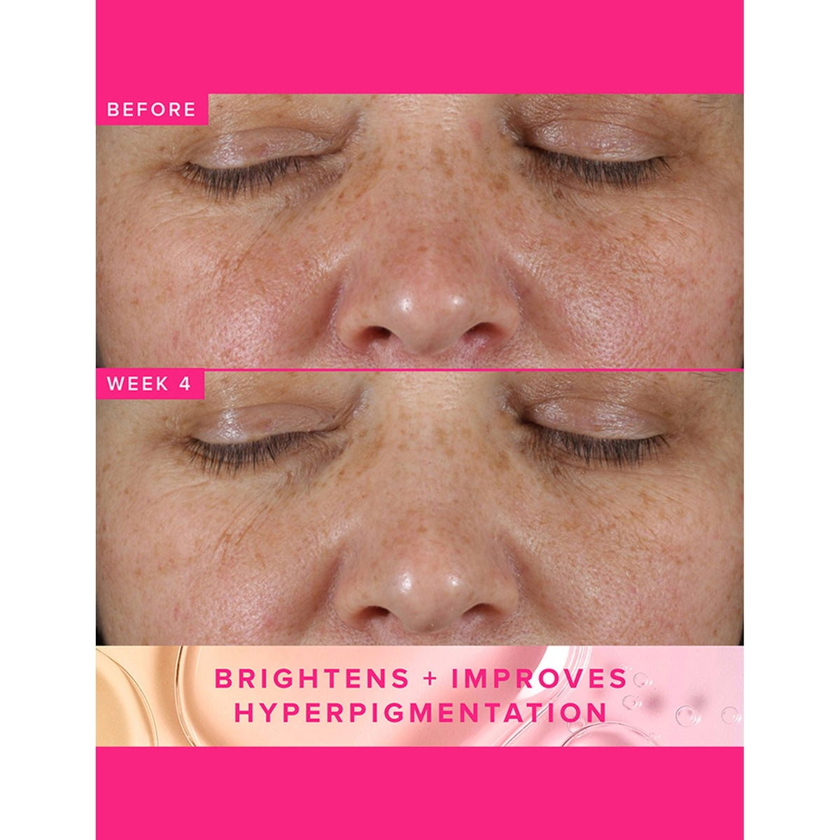 Farmacy Beauty Brighten Up 3% TXA Dark Spot Toner | Grocsy