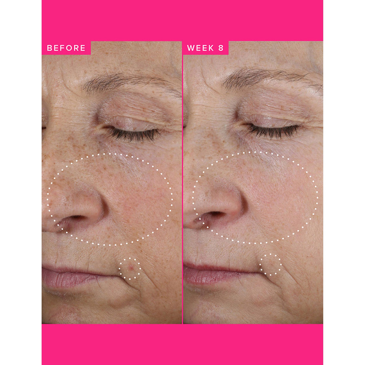 Farmacy Beauty Brighten Up 3% TXA Dark Spot Toner | Grocsy