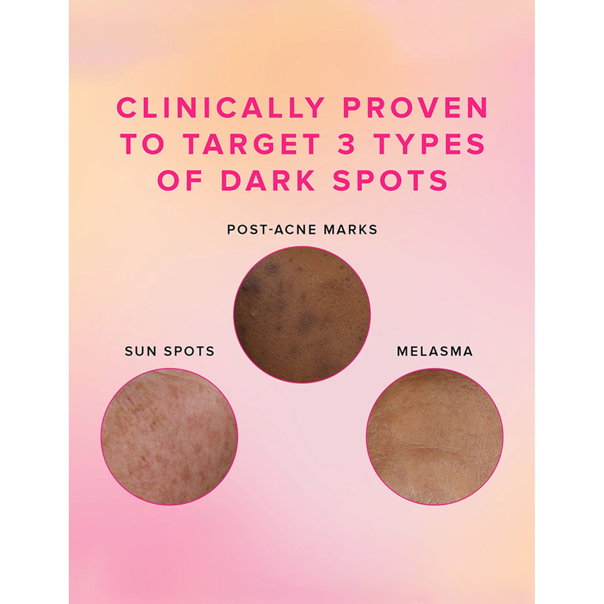 Farmacy Beauty Brighten Up 3% TXA Dark Spot Toner | Grocsy