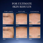 Lancome Genifique Ultimate Skin Repair Serum With Beta Glucan | Grocsy