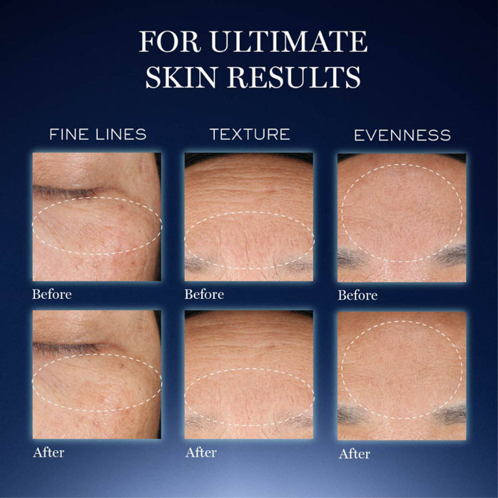Lancome Genifique Ultimate Skin Repair Serum With Beta Glucan | Grocsy