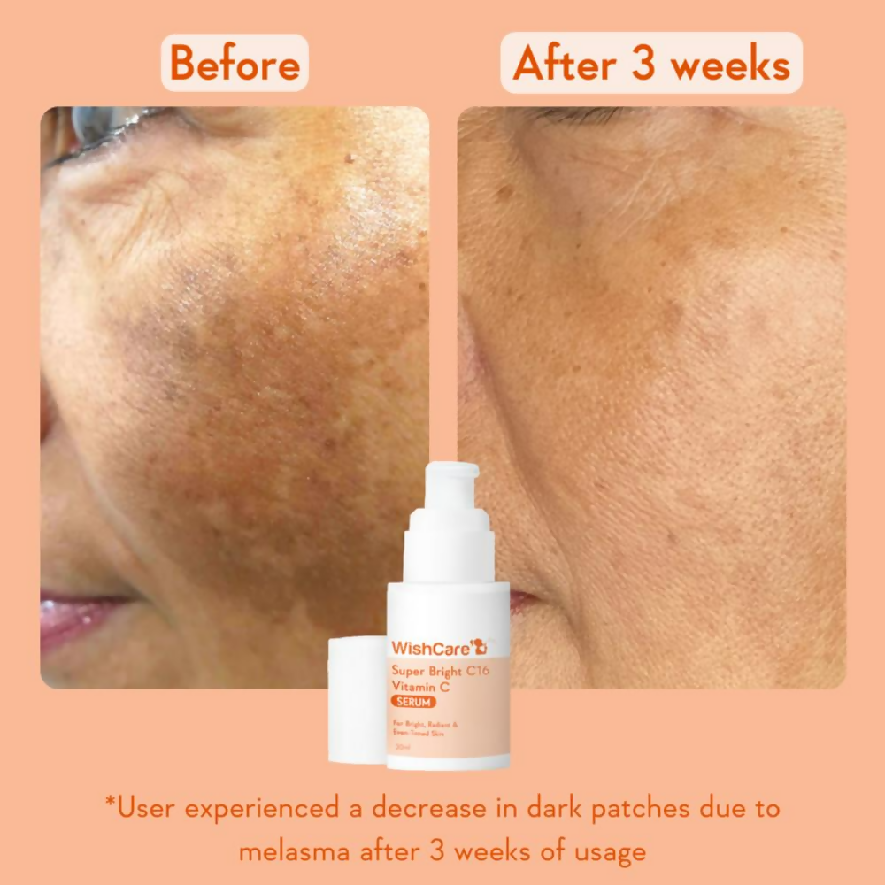 Wishcare Super Bright C16 Vitamin C Face Serum | Grocsy