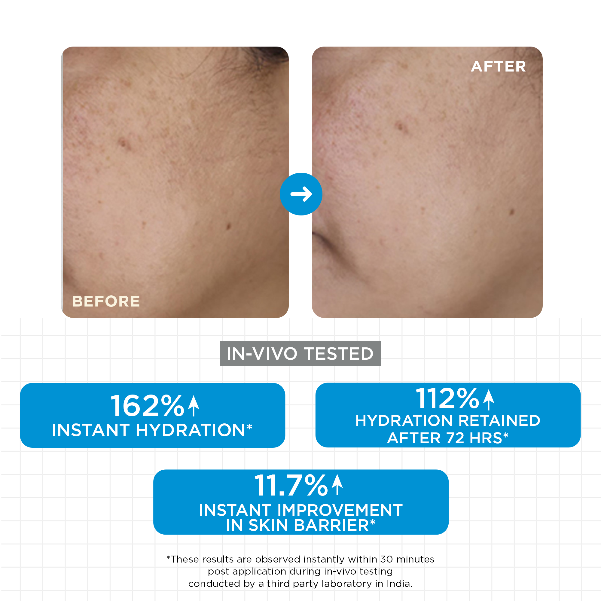 SkinQ Moisture Balm | Grocsy