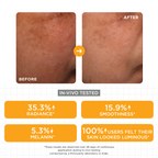 SkinQ Brightening Serum with Kojic, Lactic & Malic Acid | Grocsy