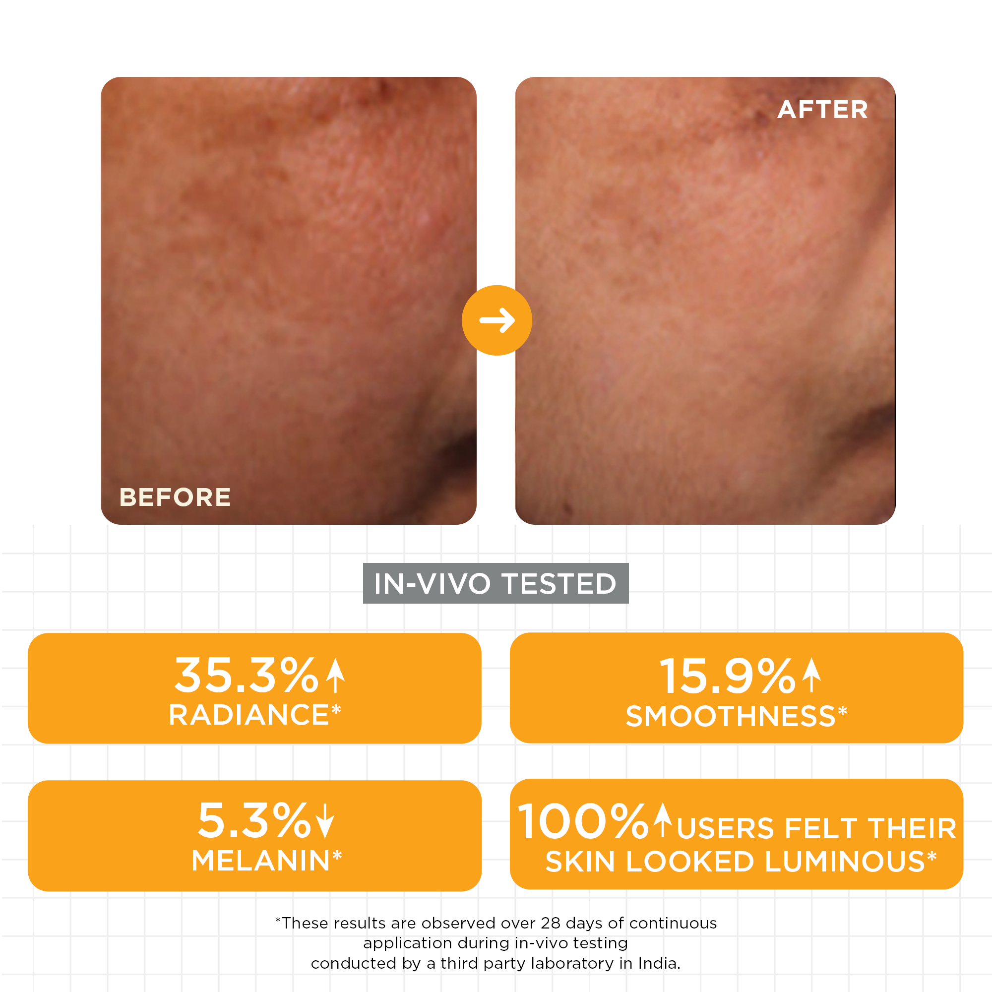 SkinQ Brightening Serum with Kojic, Lactic & Malic Acid | Grocsy