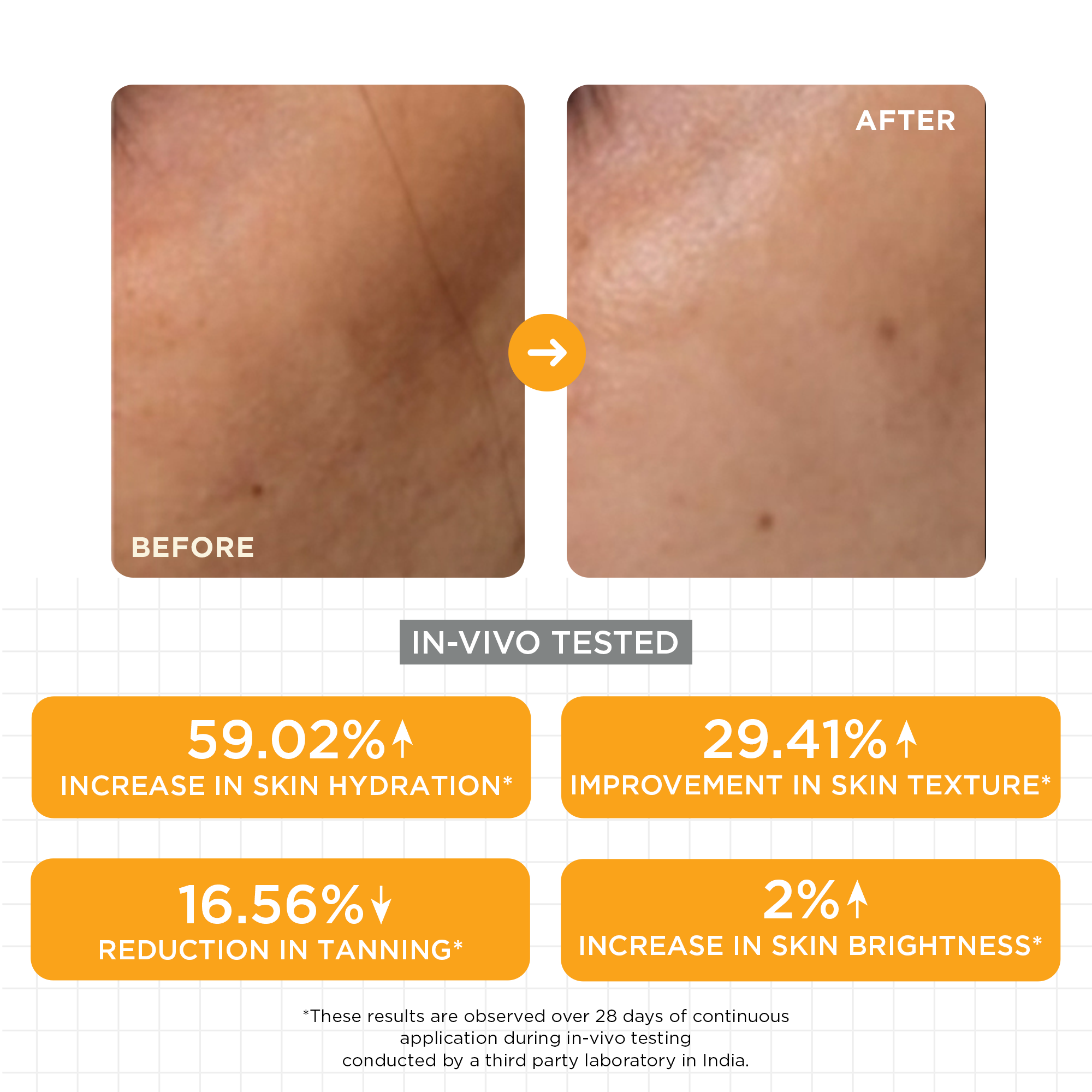 SKINQ 15% Vitamin C Glow Serum with L Ascorbic & Ferulic Acid | Grocsy