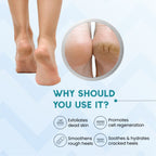 SANCTUS 20% Urea & Hyaluronic Foot Cream Roll On | Grocsy