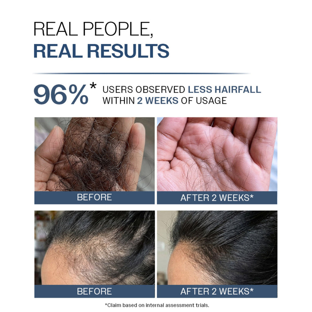 Bare Anatomy Anti-Hair Fall Shampoo 5X Hair Fall Control With Peptides | Grocsy