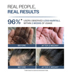 Bare Anatomy Anti-Hair Fall Shampoo 5X Hair Fall Control With Peptides | Grocsy