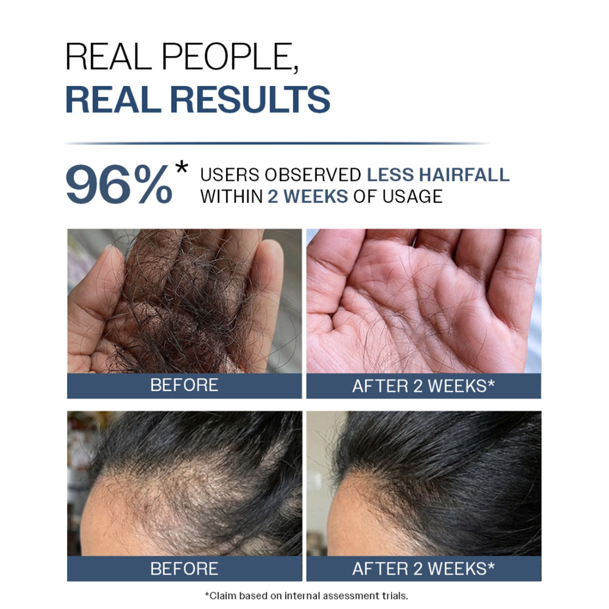 Bare Anatomy Anti-Hair Fall Shampoo 5X Hair Fall Control With Peptides | Grocsy