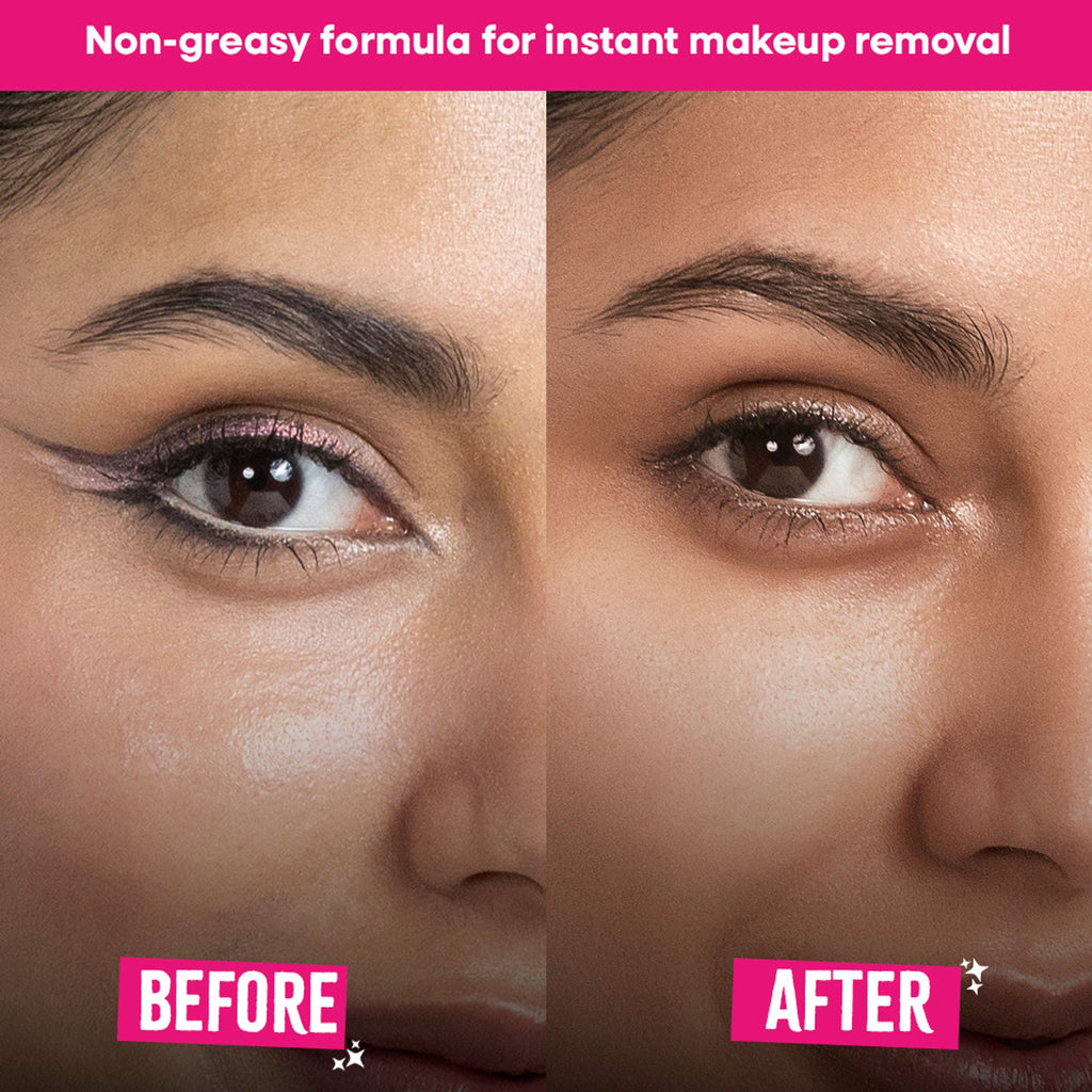 Nykaa Micellar Melter Cleansing Water - Sensitive Skin Gentle Cleanser With Vitamin C & Niacinamide | Grocsy