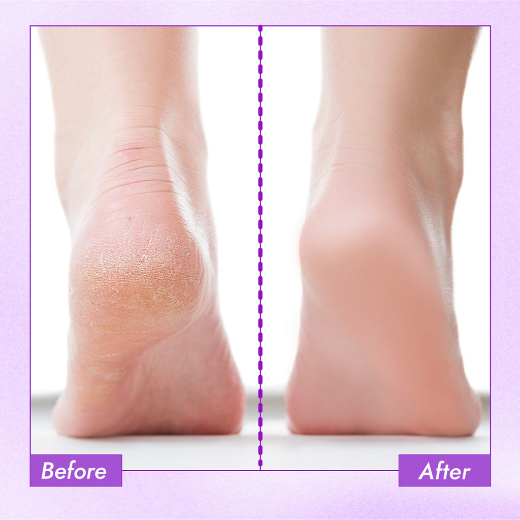 Nykaa Skin Happy Heels 20%Urea, 2%Lactic Acid Foot Cream-Dry & Cracked Feet - Lavender & Peppermint | Grocsy