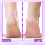 Nykaa Skin Happy Heels 20%Urea, 2%Lactic Acid Foot Cream-Dry & Cracked Feet - Lavender & Peppermint | Grocsy