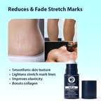 Dermistry Stretch Marks Scar Removal Roll On Oil Serum | Grocsy