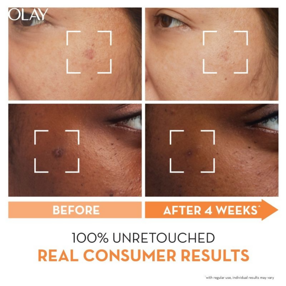 Olay Vitamin C Kit For 2x Glow - Cream With Free Cleanser | Grocsy
