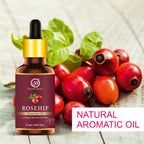 Nuerma Science Rosehip Essential Oil For Anti-Aging | Grocsy