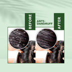 Nuerma Science Anti-Dandruff Hair Oil | Dandruff Relief & Scalp Rejuvenation | Grocsy