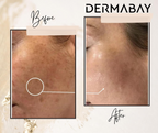 Dermabay Skin Brightening Face Serum With Kojic Acid & Alpha Arbutin | Grocsy