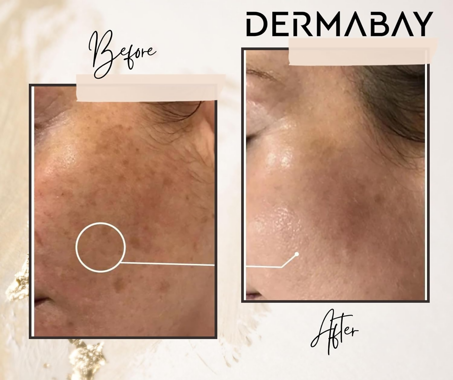 Dermabay Skin Brightening Face Serum With Kojic Acid & Alpha Arbutin | Grocsy