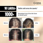 QSERA Hair Serum for Hair Fall Control | Grocsy
