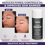 Sanfe 2% BHA Pore Cleansing Toner | Grocsy
