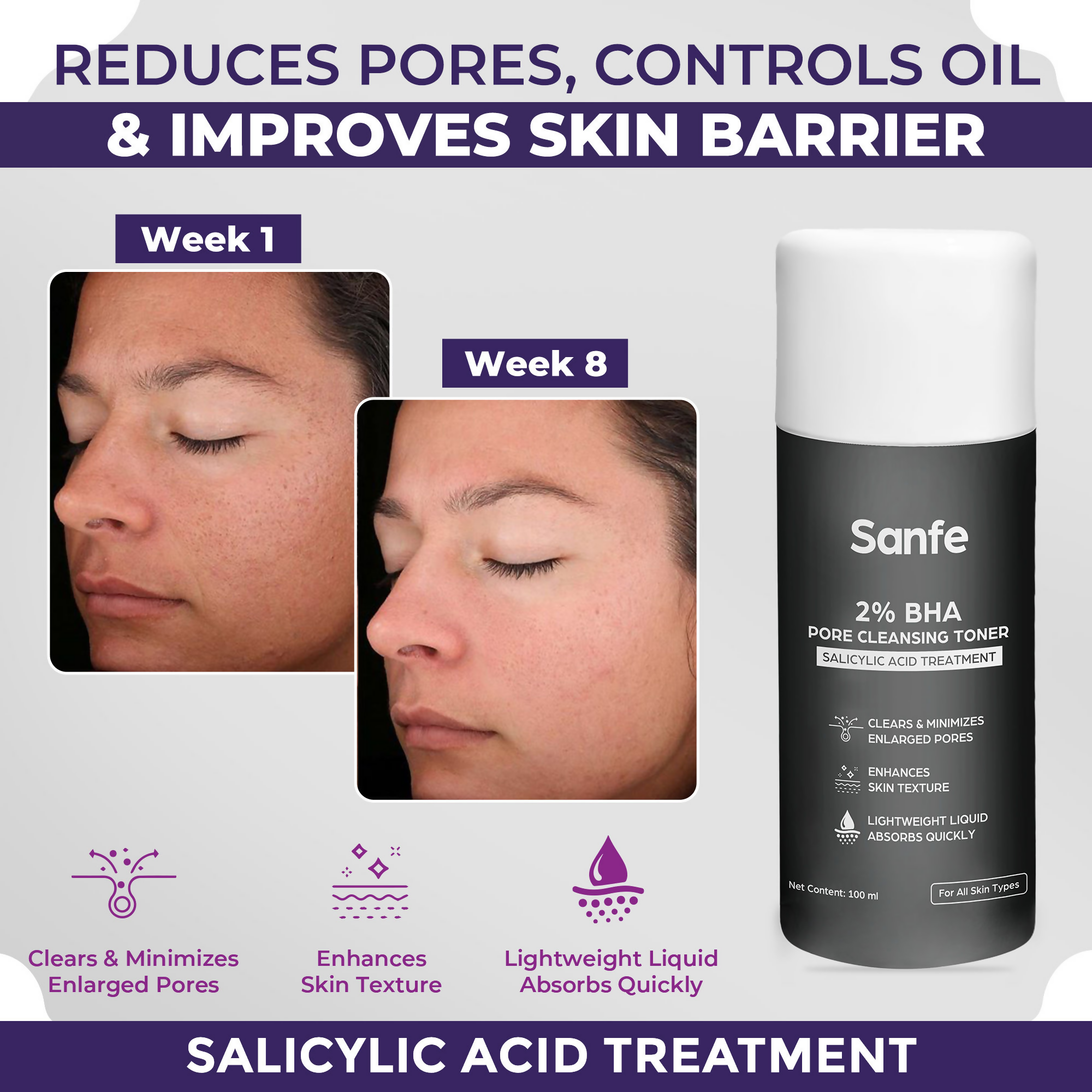 Sanfe 2% BHA Pore Cleansing Toner | Grocsy