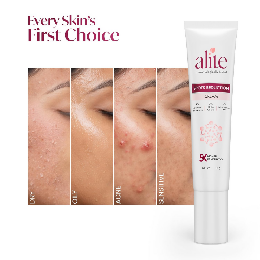 Alite Spots Reduction Cream with 5X Enhanced Absorption | Grocsy