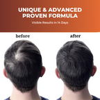 Prisa Organics Hair Re Growth Serum | Grocsy
