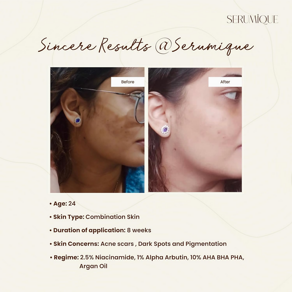 Serumique Niacinamide Face Serum - Hello Even Tone Pro Conc. 2.5% | Grocsy