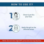 FCL Alpha Beta Acne Gel | Grocsy