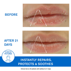Uriage Bariederm-Cica Protecting Lip Balm For Dry,Cracked & Chapped Lips With Squalane & PHytosterol | Grocsy