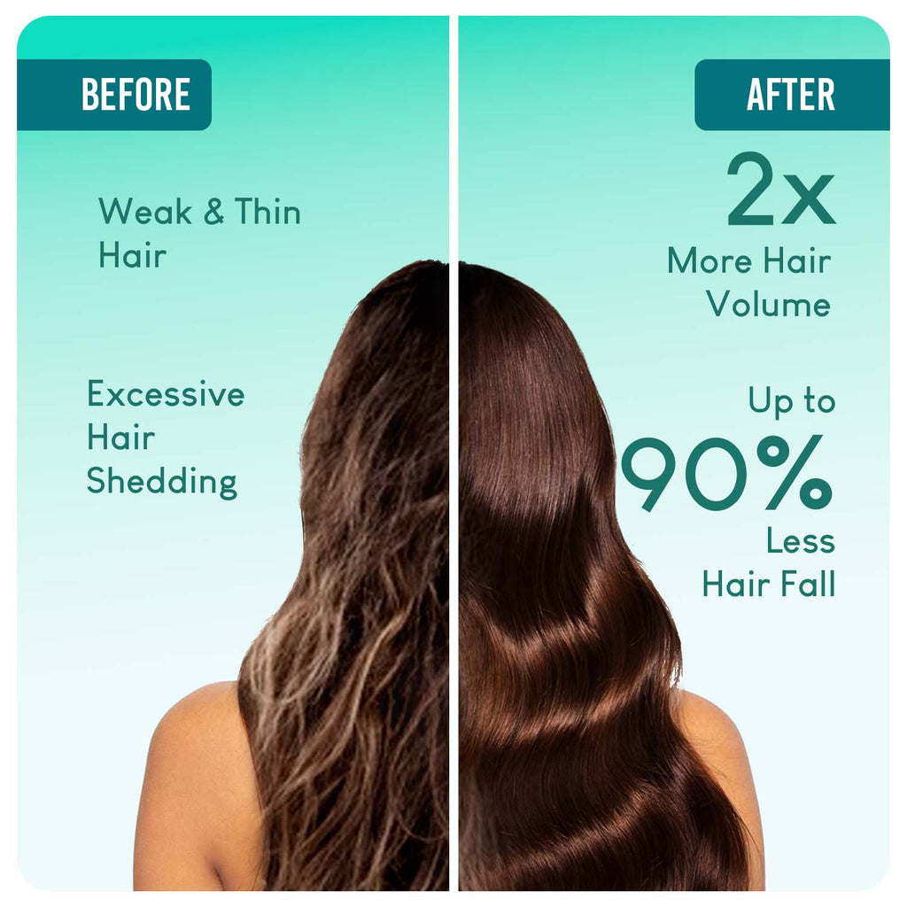Careberry 100% Organic Rosemary & Jojoba Anti Dandruff Hair Oil | Grocsy