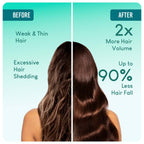 Careberry 100% Organic Rosemary & Jojoba Anti Dandruff Hair Oil | Grocsy