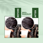 Nuerma Science Anti-Dandruff Oil | Rejuvenate Your Scalp, Rediscover Confidence | Grocsy