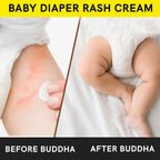 Buddha Natural Baby Diaper Rash Cream | Grocsy