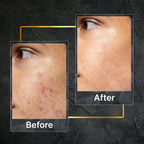 Tru Hair & Skin Nanotechnology Facewash For Sensitive-Acne Prone Skin | Grocsy
