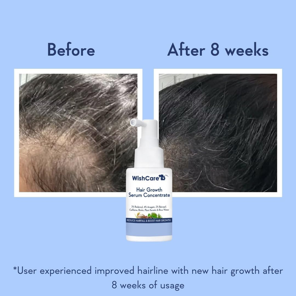 Wishcare Hair Growth Serum Concentrate With 3% Redensyl, 4% Anagain, Rice Water, Biotin | Grocsy