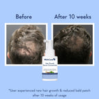 Wishcare Hair Growth Serum Concentrate With 3% Redensyl, 4% Anagain, Rice Water, Biotin | Grocsy