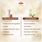 Inveda Teen's Care Acne Pore Cleanser | Grocsy