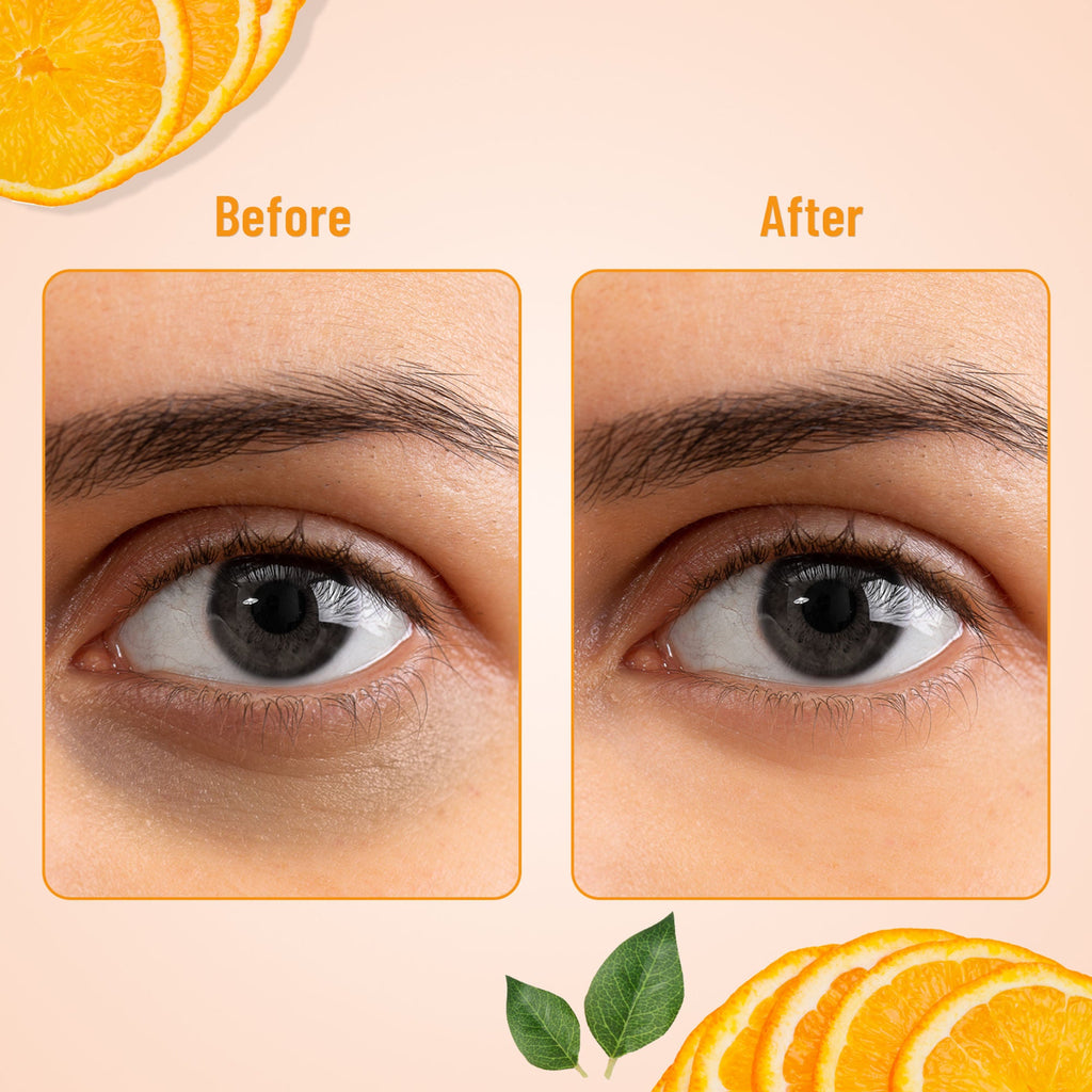 Swiss Beauty Hydra Eye Serum Patches For Dark Circles And Puffiness , Hydrate Skin - Vitamin-C | Grocsy
