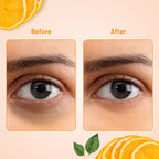 Swiss Beauty Hydra Eye Serum Patches For Dark Circles And Puffiness , Hydrate Skin - Vitamin-C | Grocsy