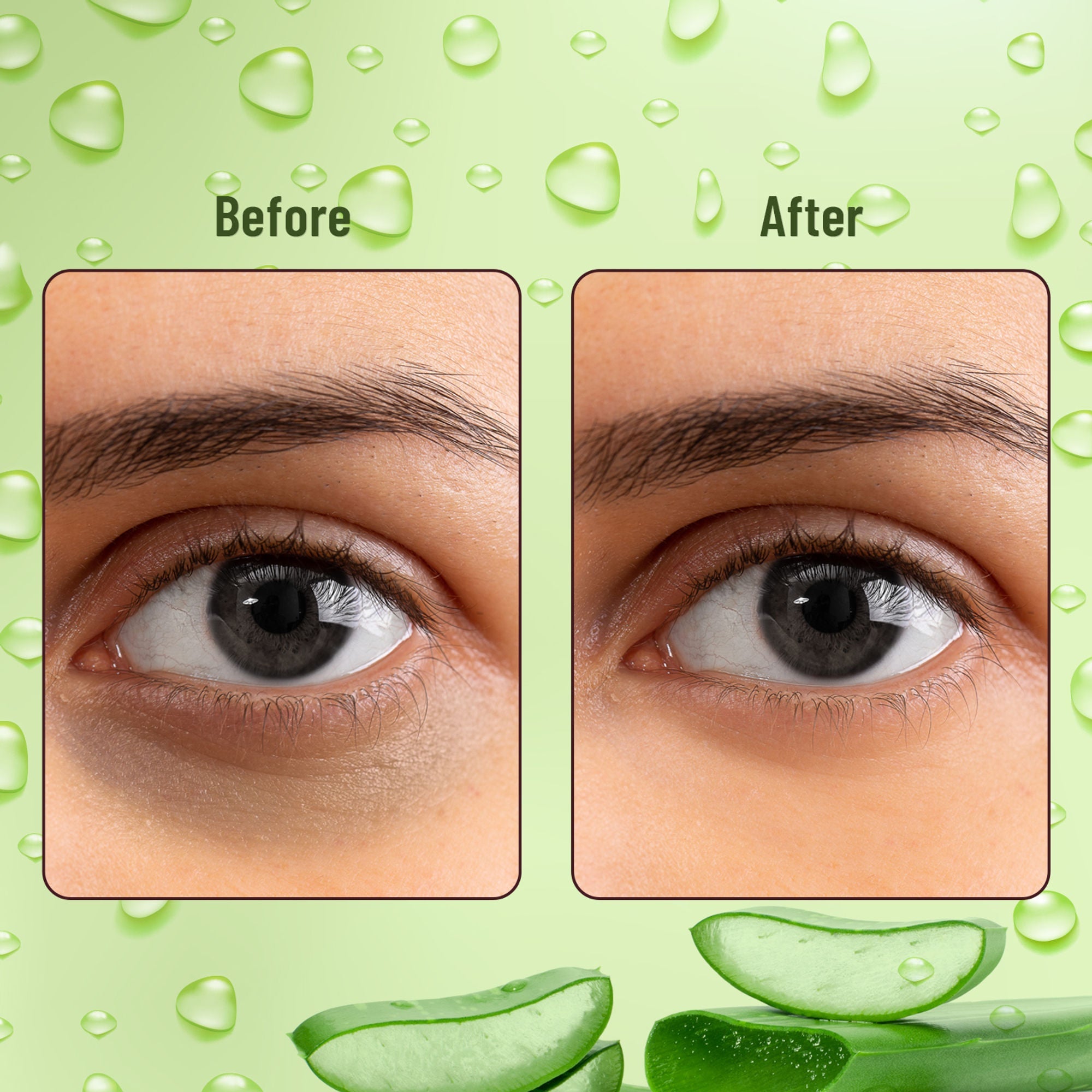 Swiss Beauty Hydra Eye Serum Patches For Dark Circles And Puffiness , Hydrate Skin - Alove Vera | Grocsy