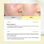 Dr.Althea 345 Relief Cream: Soothing & Barrier Repair Cream with power of Niacinamide & Panthenol | Grocsy