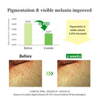Dr.Althea Gentle Vitamin C Serum: Low-Irritation Brightening Serum for Sensitive Skin | Grocsy