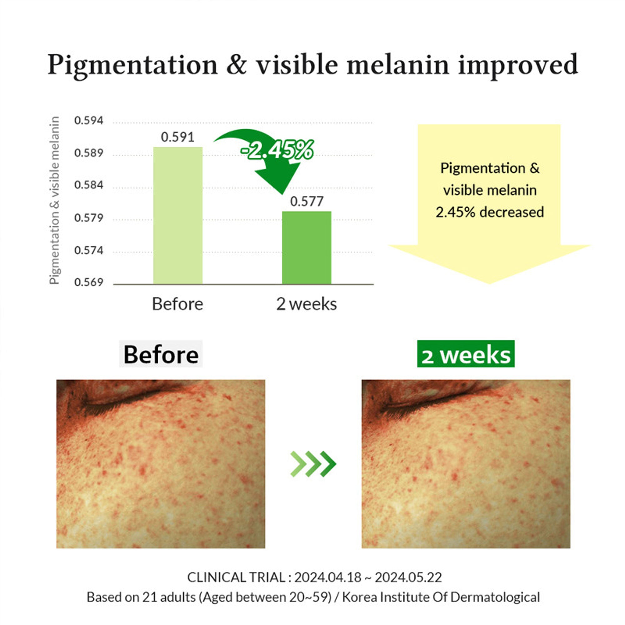 Dr.Althea Gentle Vitamin C Serum: Low-Irritation Brightening Serum for Sensitive Skin | Grocsy